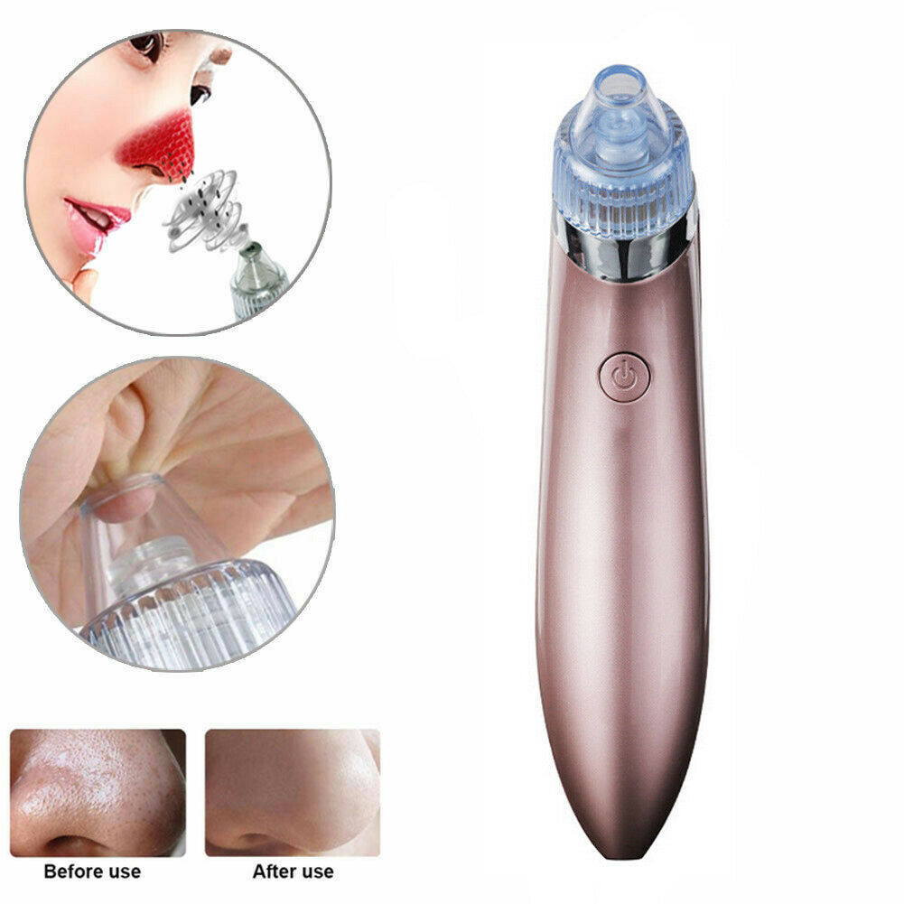 Removedor eléctrico de puntos negros, aspirador de poros con succión y limpiador facial con dermoabrasión con punta de diamante.