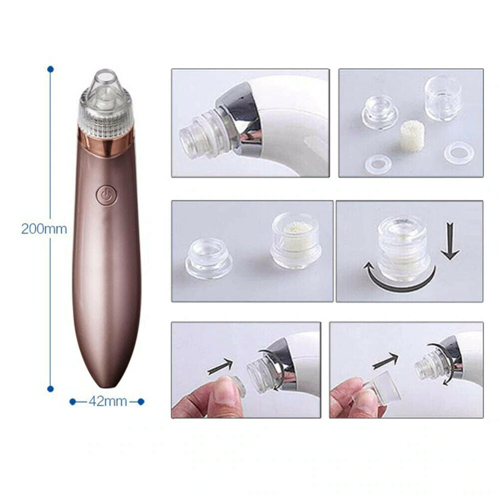 Removedor eléctrico de puntos negros, aspirador de poros con succión y limpiador facial con dermoabrasión con punta de diamante.