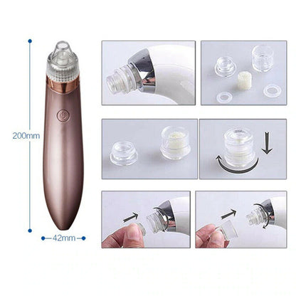 Removedor eléctrico de puntos negros, aspirador de poros con succión y limpiador facial con dermoabrasión con punta de diamante.