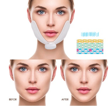 Dispositivo de lifting facial en forma de V