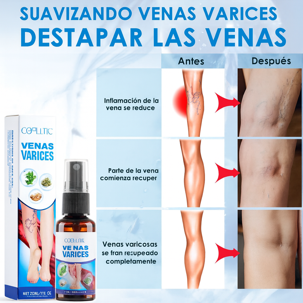 Spray para Venas Varicosas