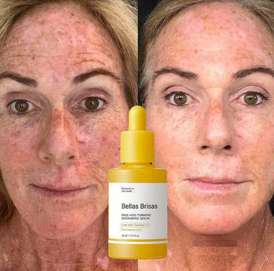 Kojic Acid Turmeric