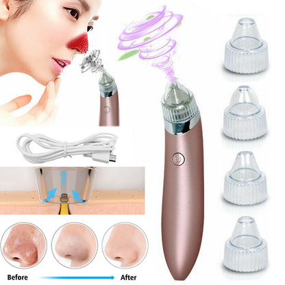 Removedor eléctrico de puntos negros, aspirador de poros con succión y limpiador facial con dermoabrasión con punta de diamante.