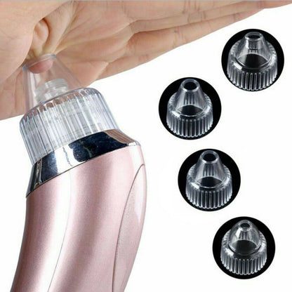 Removedor eléctrico de puntos negros, aspirador de poros con succión y limpiador facial con dermoabrasión con punta de diamante.