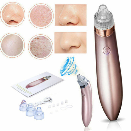 Removedor eléctrico de puntos negros, aspirador de poros con succión y limpiador facial con dermoabrasión con punta de diamante.